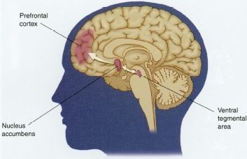 Addiction is believed to change the brain's pleasure circuits and pathways. A complex cascade of signals within the brain creates the craving that characterizes addiction. Thus, an addiction to a substance may be both psychological and physiological, as the body creates demands that are out of the person's control.