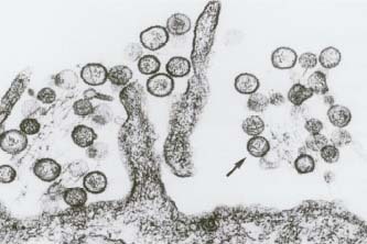 An electron micrograph shows Ebola virus particles. Delmar Publishers, Inc.