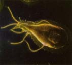 Both public water supplies and natural water sources can become contaminated with human or animal waste (mainly from dogs and beavers) harboring the parasite (shown here) that causes giardiasis. The disease causes stomach upset and diarrhea when the parasite attaches itself to the lining of the digestive system, where it interferes with the body's ability to absorb fats and carbohydrates. Custom Medical Stock Photo, Inc.
