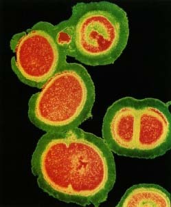 Seen under an electron microscope are Staphylococcus aureus bacteria from a group that is resistant to antibiotics. Some of them are dividing to reproduce. Dr. Kari Lounatmaa/Science Photo Library, Photo Researchers, Inc.