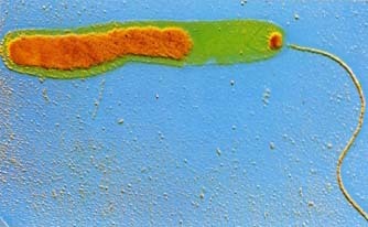 The Vibrio cholerae bacterium under an electron microscope. Color has been added to show the nucleic acid (orange) and the flagellum (tail), which is used by the bacterium to move. CNRI/Science Photo Library, Photo Researchers, Inc.