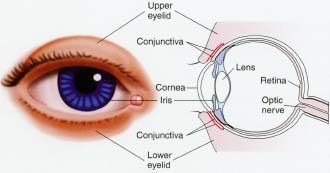 In conjunctivitis, the membrane that lines the eyelids and covers the eye becomes inflamed and swollen.