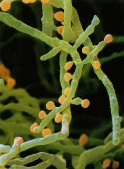 The Trichophyton fungus, photographed under an electron microscope at more than 4,000 times its original size, causes ringworm of the scalp (tinea capitis). The fungus is reproducing by flowering. © Oliver Meckes/Photo Researchers, Inc.
