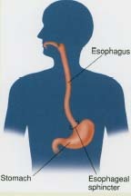 Heartburn occurs when the contents of the stomach move backward through the muscular valve called the lower esophageal sphincter and up into the esophagus. The stomach's acid and digestive enzymes irritate the lining of the esophagus, causing a burning feeling in the chest and a bitter, sour taste in the throat and mouth.