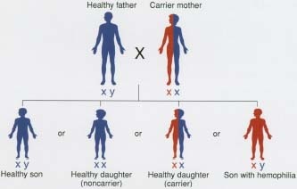 The gene for hemophilia is unintentionally passed from mothers (XX) to sons (XY) via the X chromosome. A son who inherits a defective X chromosome from his mother does not have a healthy X chromosome to rely on the way daughters (XX) do.