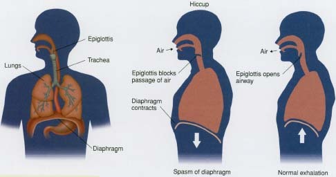 Hiccups occur when the diaphragm and lungs suddenly contract during breathing.