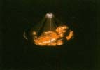 Sonogram of a healthy fetus. © Lutheran Hospital/Peter Arnold, Inc.