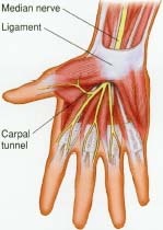 Carpal tunnel syndrome affects people who overuse their hands on piano or computer keyboards.