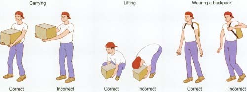 Correct versus incorrect posture: carrying loads, lifting, wearing backpack