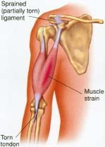 Strains and sprains are injuries to the muscles, tendons, and ligaments.