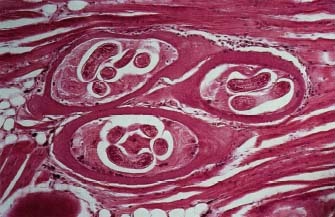 Cysts in muscle tissue containing Trichinella larvae. © EdReschke, Peter Arnold, Inc.